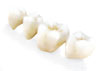 Dental Bridge